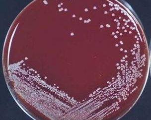 Staphylococcus epidermidis (Staphylococcus epidermidis) – sintomas, causas, tratamento. Seja qual for a norma nas análises