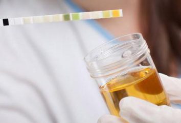 Biochimica di urina: le regole e le norme di figure di raccolta