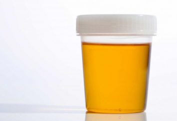 Di che colore dovrebbe nell'urina di una persona sana?