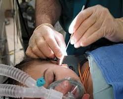 Ohrchirurgie: Indikationen, Arten