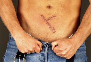 Las suturas de proceso después de la cirugía? consejos diarios