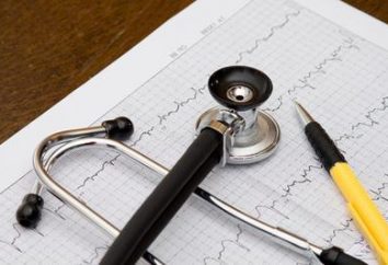 Die Entzifferung EKG – die zuverlässigste Methode für die Diagnose