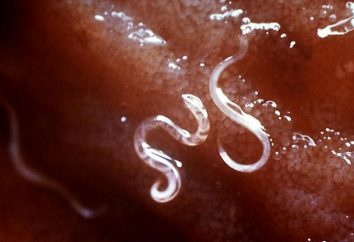 Worms im Menschen. Spulwürmer sind Parasiten-Behandlung und Prävention