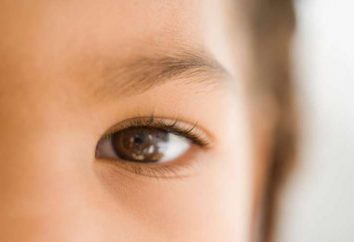 ¿Por espasmos párpado inferior del ojo izquierdo: causas y tratamiento
