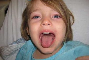 Halsschmerzen bei Kindern (3 Jahre): Die Behandlung. Angina pectoris ist ein Kind 3 Jahre: was und wie sie zu behandeln