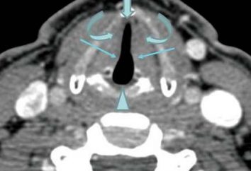 CT der Larynx: Preis Bewertungen. CT-Scan des Halses und des Rachens, die zeigen?