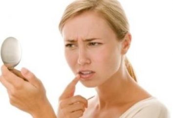 El herpes en los labios: el tratamiento en casa. ¿Con qué rapidez curar el herpes labial en los labios en el hogar?