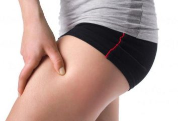 gamba Numb dall'anca al ginocchio – cosa fare e come trattare?