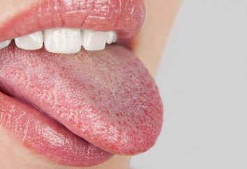Perché aggrotta bocca: cause, sintomi e le caratteristiche di trattamento