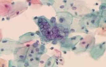 El herpes tipo 6 – lo que este virus es y cómo se trata?