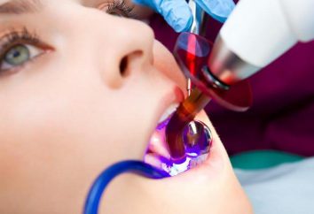 polimerizzazione lampada dentale: il motivo per cui è necessario e come scegliere esso?