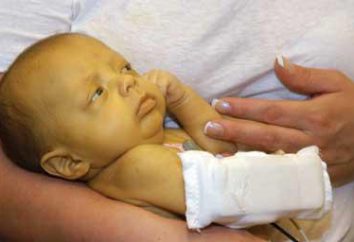 Bilirubina: la norma in un neonato. Tabella per mesi
