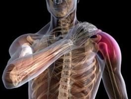 lesión deportiva de la articulación del hombro