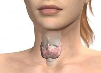Glande thyroïde agrandie: causes et degrés