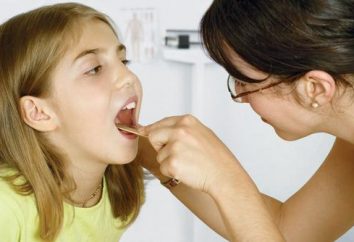 Purulenta tonsillite il bambino: cause, sintomi, il trattamento