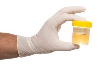 O exame de urina. Como coletar e interpretar os resultados?