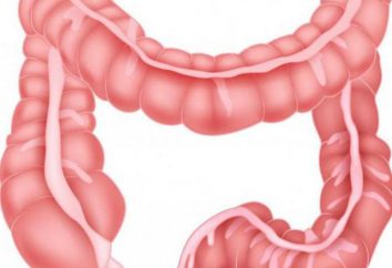 colon trasverso: la sua struttura e tipi di malattie