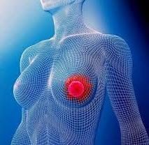 Was ist die Brust, Ursachen, Symptome und Behandlung