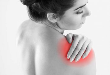 Cosa e come trattare capsulite dell'articolazione della spalla?