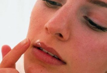 Wie wird man auf den Lippen der Kälte zu befreien: eine Liste der effektivsten Methoden