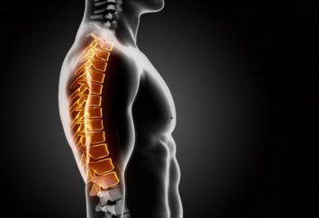 colonna vertebrale osteoartrite: diagnosi, sintomi e trattamento
