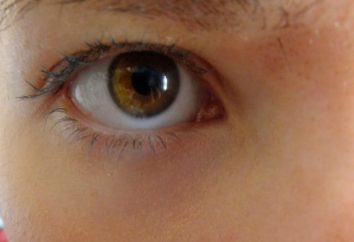 Amarelado sob os olhos: as causas e características de tratamento