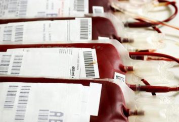 transfusão de sangue para os grupos sanguíneos: regras. doadores universais. grupos de compatibilidade de sangue Tabela