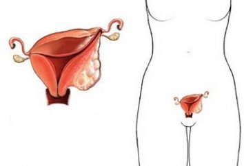 I principali segni di cancro uterino