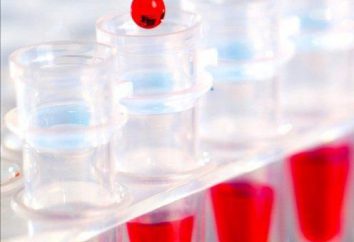 Comment se préparer à la fourniture de l'analyse biochimique du sang? Comme vous vous préparez pour la fourniture de sang à l'analyse biochimique du patient?