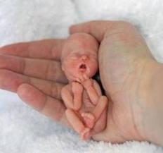 Chirurgiczna aborcja: czy warto?