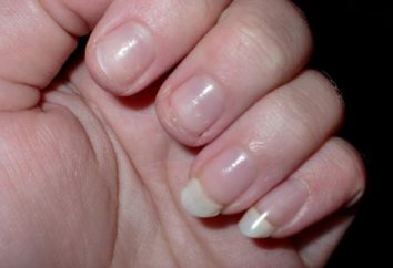 Nails esfoliar e romper – o que fazer? Fortalecimento banho para unhas