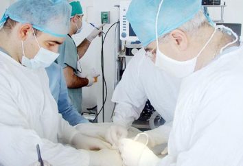 La operación de apendicitis. ¿Cuál es la esencia?