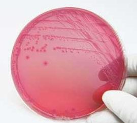 Escherichia coli im Abstriche: Wie ernst?