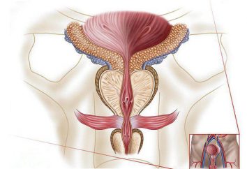 consequências perigosas de prostatite crônica: uma descrição e características
