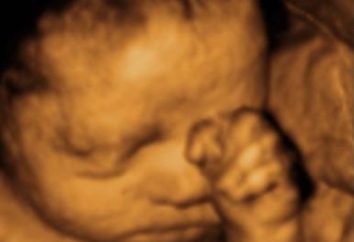 Die Bestimmung des Geschlechts des Babys auf dem Ultraschall, so genau