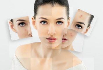Podskórne krosty na twarzy: przyczyny, zabiegi, leki