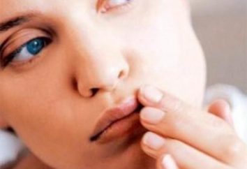 O que significa herpes labial aparece: causas, prevenção, recursos de tratamento