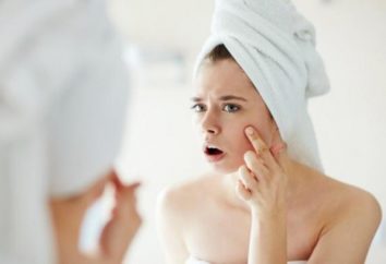 causas inesperadas del acné odiado