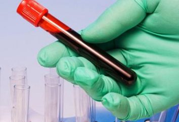 Qual è la necessità di un esame del sangue per l'oncologia?