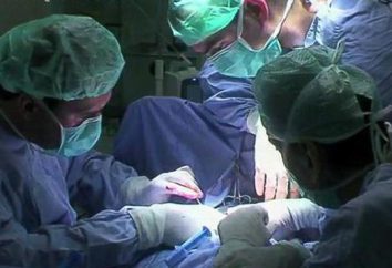 Pene metodi di chirurgia allargamento: Metodo e recensioni su di loro