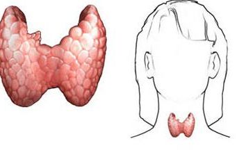 La glande thyroïde est agrandie: les symptômes. Les premiers symptômes de maladies de la thyroïde