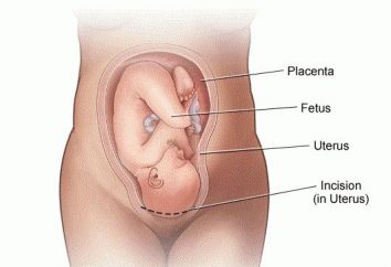 Co się dzieje w czasie ciąży, gdy żołądek jest opuszczona przed porodem
