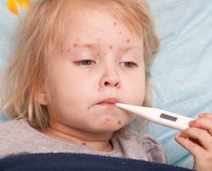 Come riconoscere i primi segni di meningite in un bambino
