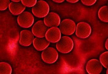 Aglutynacja krwi to … Grupa krwi i reakcje aglutynacji