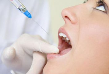 anestesia Torusalnaya em odontologia: de aparelhos, Zona anestesia