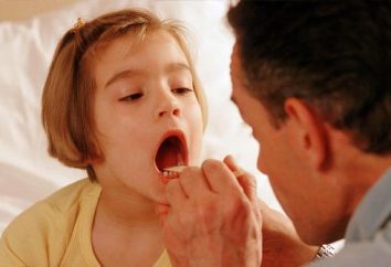 Jak leczyć anginę u dzieci