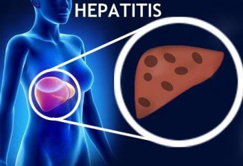 Hepatitis A – Was ist diese Krankheit? Symptome, Behandlung und Prävention von Hepatitis A