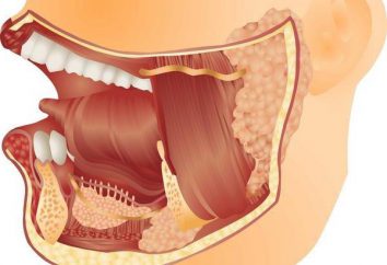 ¿Dónde está la glándula salival parótida? La inflamación de la glándula parótida: causas, síntomas, tratamiento