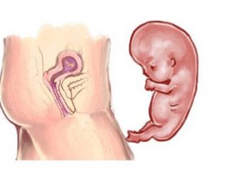 Jak pozbyć się ciąży we wczesnych stadiach: metody tradycyjne i nietradycyjne
