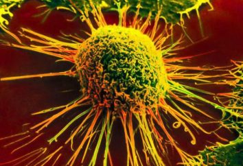 markery nowotworowe: SCC szczególności badań. Co pokazuje, markerów nowotworowych?